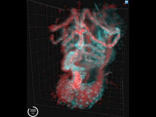 mr. michael weber, beating heart. 3d reconstruction