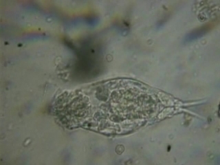 movement and feeding of the rotifer (presumably cephalodella sp.)