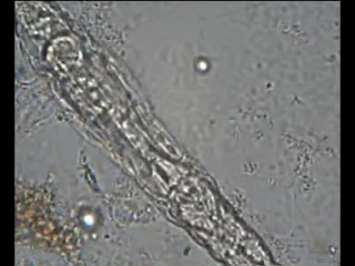 rotiferous movement