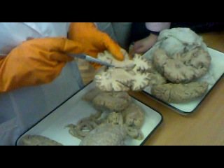 anatomy. brain structures.