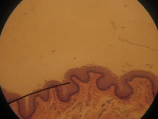 histology - transition of the esophagus to the stomach